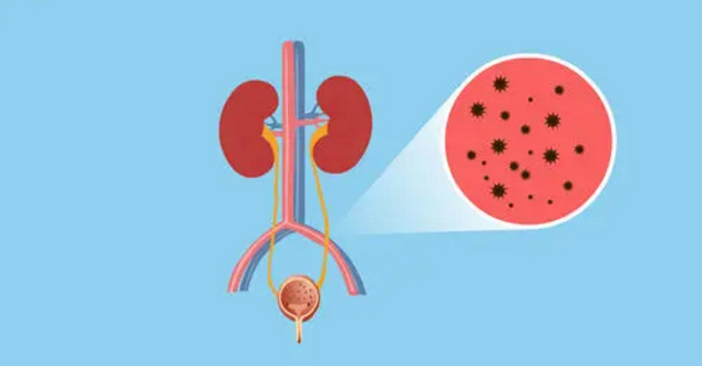 體內(nèi)有結(jié)石，飲食要注意！